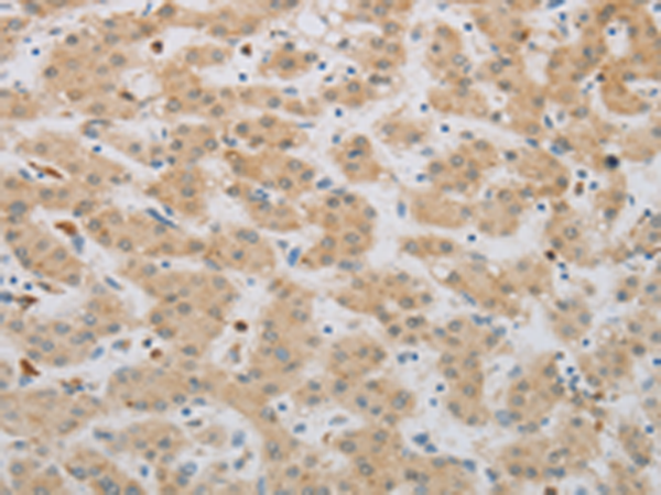 Rabbit Polyclonal Antibody to NBN