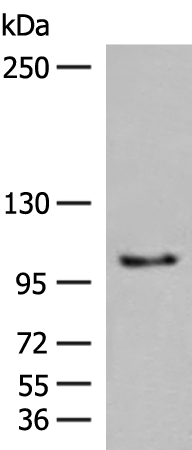 Rabbit Polyclonal Antibody to CDH1