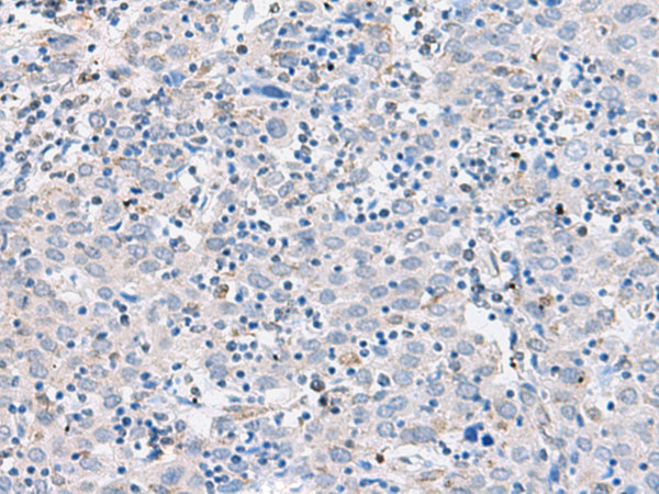 Rabbit Polyclonal Antibody to CDH2