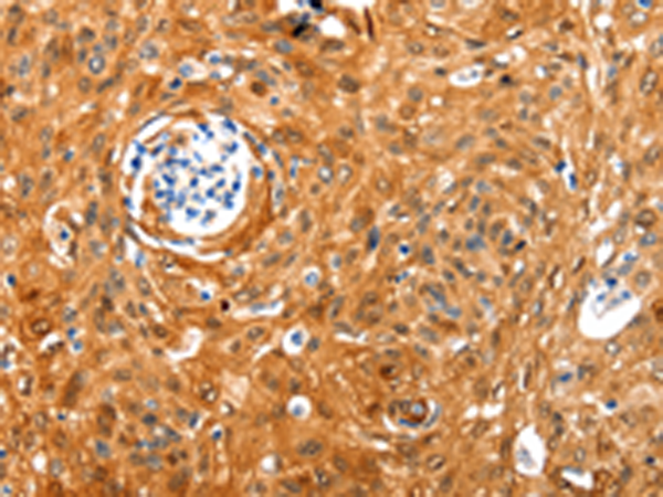 Rabbit Polyclonal Antibody to NCOR1