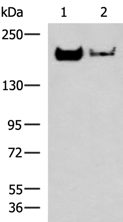 Rabbit Polyclonal Antibody to NCAN