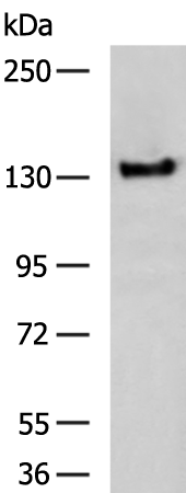 Rabbit Polyclonal Antibody to NFASC