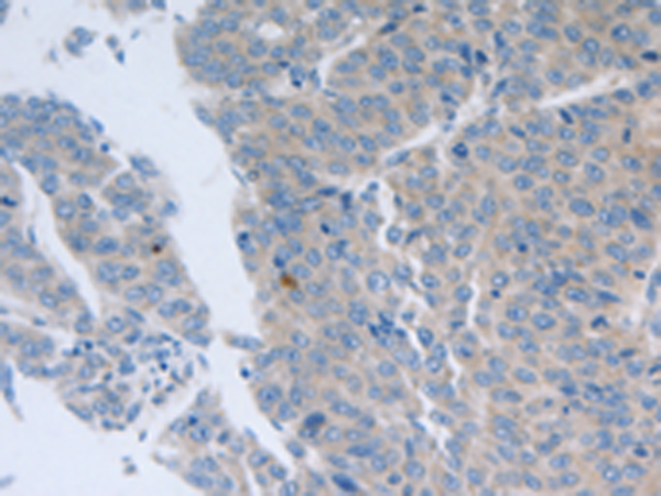 Rabbit Polyclonal Antibody to GRIN1