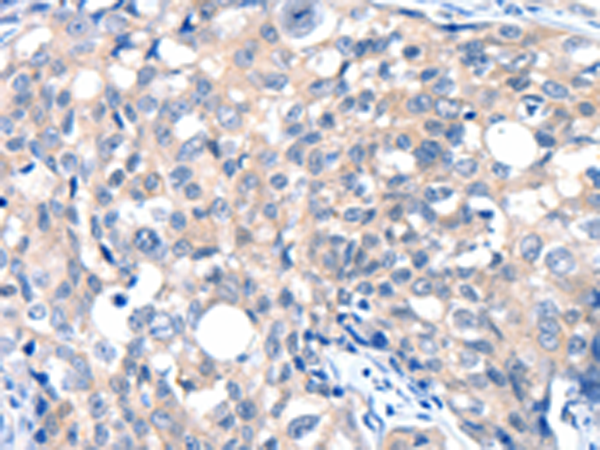 Rabbit Polyclonal Antibody to GRIN2D