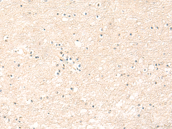 Rabbit Polyclonal Antibody to GRIA1