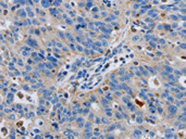 Rabbit Polyclonal Antibody to GRIA3