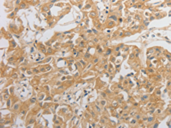 Rabbit Polyclonal Antibody to HCRTR2