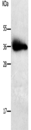 Rabbit Polyclonal Antibody to PLPP1