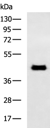 Rabbit Polyclonal Antibody to F2R