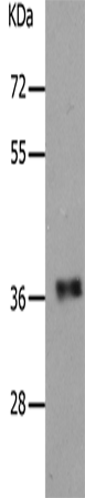 Rabbit Polyclonal Antibody to PARD6A
