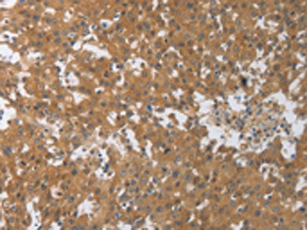 Rabbit Polyclonal Antibody to PXN