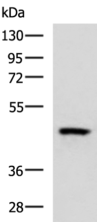 Rabbit Polyclonal Antibody to PAX5