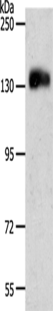 Rabbit Polyclonal Antibody to PECAM1