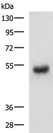 Rabbit Polyclonal Antibody to PDK4