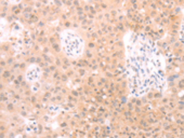 Rabbit Polyclonal Antibody to PKD2L1