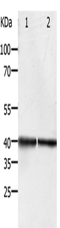 Rabbit Polyclonal Antibody to PDX1