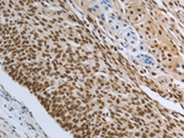 Rabbit Polyclonal Antibody to PRMT3