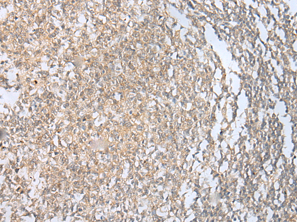 Rabbit Polyclonal Antibody to CARM1/PRMT4