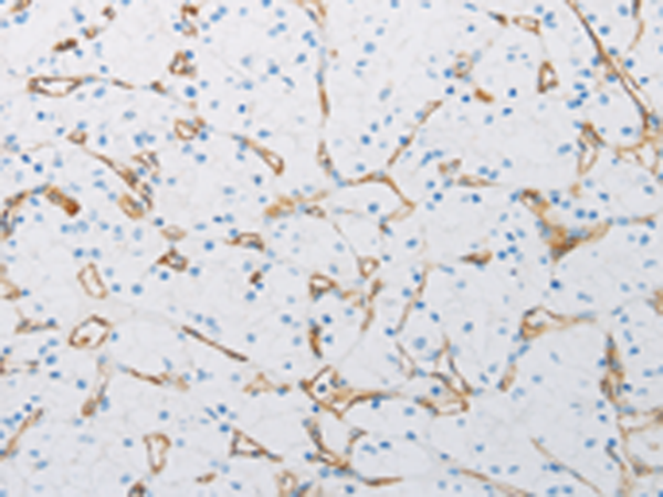 Rabbit Polyclonal Antibody to PECAM1