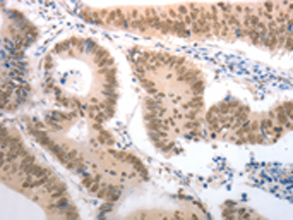 Rabbit Polyclonal Antibody to RAD52