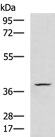 Rabbit Polyclonal Antibody to RASSF1
