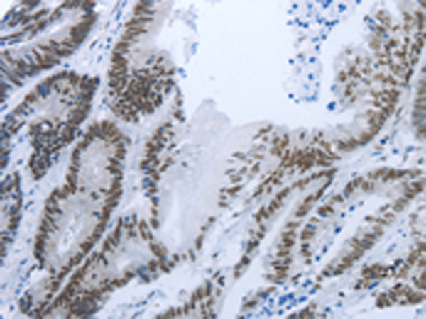 Rabbit Polyclonal Antibody to RBMS1