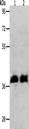 Rabbit Polyclonal Antibody to RNF126