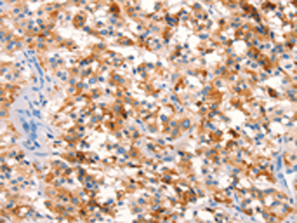 Rabbit Polyclonal Antibody to SPRN