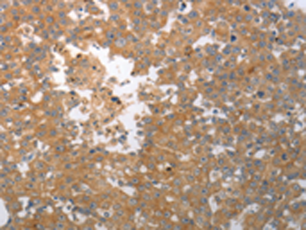 Rabbit Polyclonal Antibody to SHH