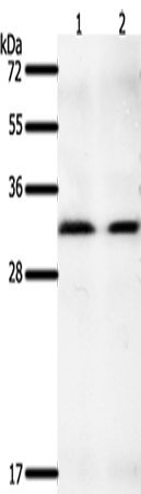Rabbit Polyclonal Antibody to GEMIN2