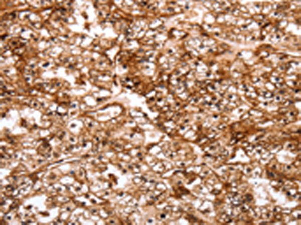 Rabbit Polyclonal Antibody to SLC9A3R2