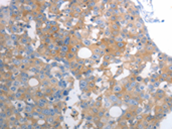 Rabbit Polyclonal Antibody to SLC12A6