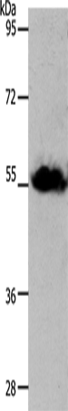 Rabbit Polyclonal Antibody to SLC1A4