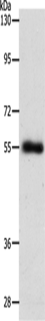 Rabbit Polyclonal Antibody to SLC1A5