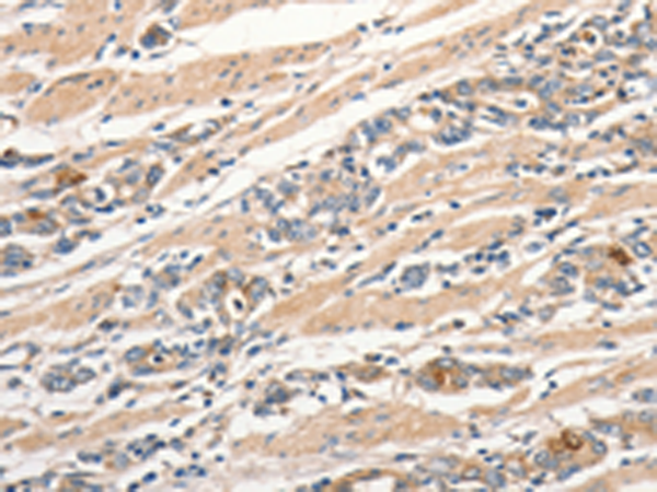 Rabbit Polyclonal Antibody to SLC41A2