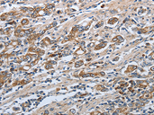 Rabbit Polyclonal Antibody to SLC34A2
