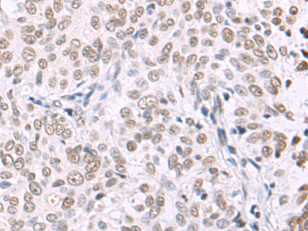 Rabbit Polyclonal Antibody to SMAD7