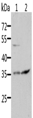 Rabbit Polyclonal Antibody to SOCS1