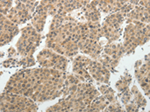 Rabbit Polyclonal Antibody to SOCS7