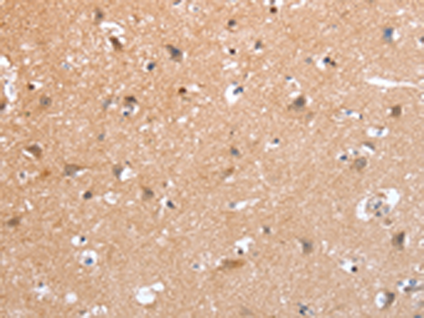 Rabbit Polyclonal Antibody to PSPN