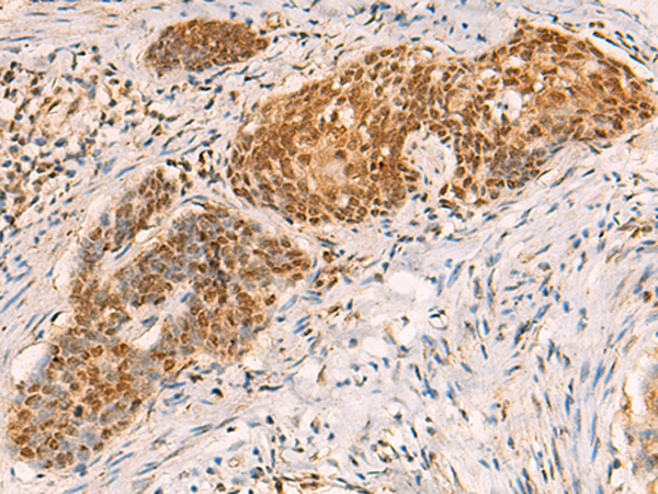 Rabbit Polyclonal Antibody to SREBF2