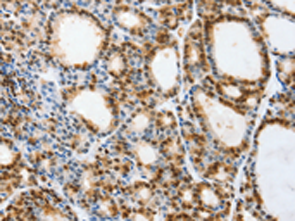 Rabbit Polyclonal Antibody to SELENOS
