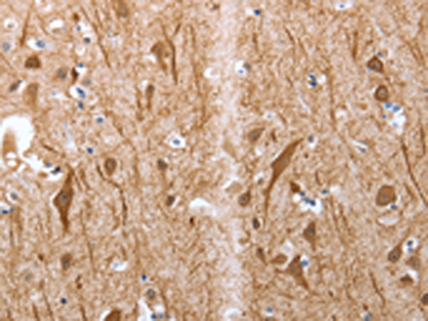 Rabbit Polyclonal Antibody to Map2
