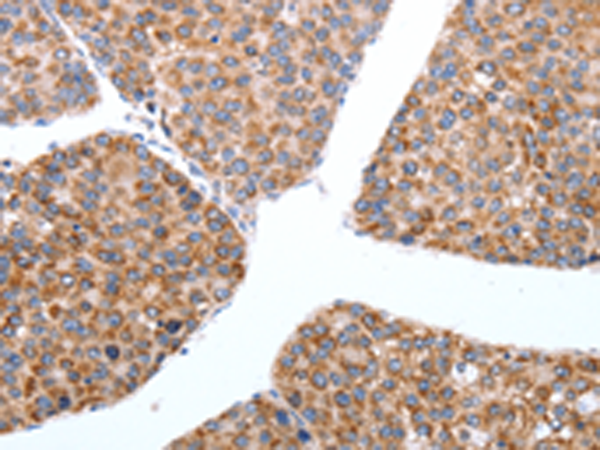 Rabbit Polyclonal Antibody to MAP3K4