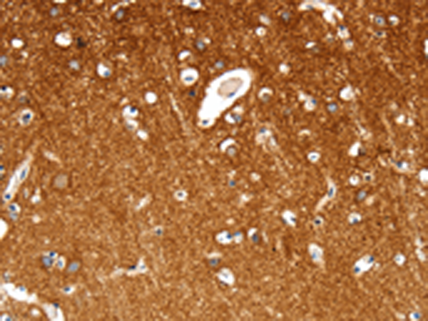 Rabbit Polyclonal Antibody to MAP4K1