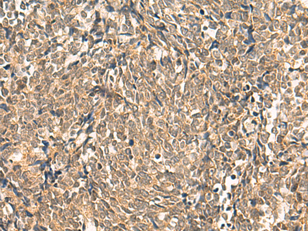 Rabbit Polyclonal Antibody to HNF1A