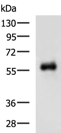 Rabbit Polyclonal Antibody to HNF1B