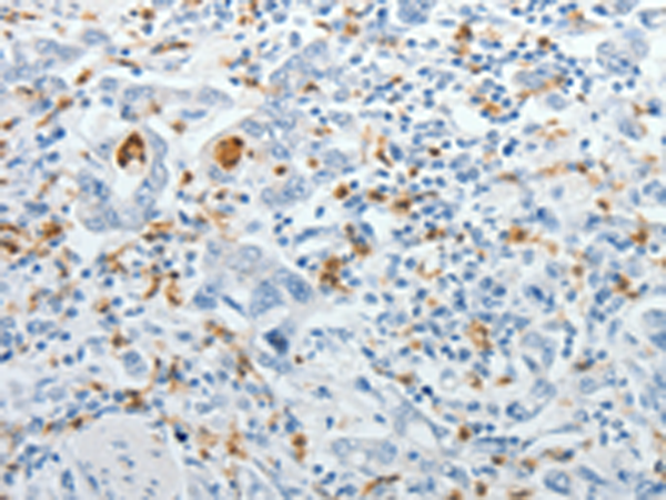 Rabbit Polyclonal Antibody to TOP1MT