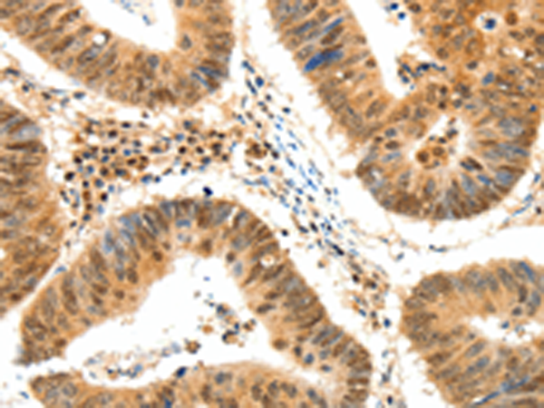 Rabbit Polyclonal Antibody to TERF2