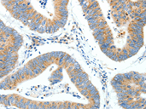 Rabbit Polyclonal Antibody to NTRK1